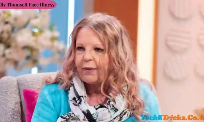 Sally Thomsett Face Illness